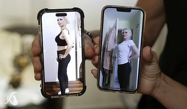 Vorher-Nachher-Vergleich: Rechts hat Daniela Katzenberger noch ihre großen Implantate, links zeigt sie nach der OP. Vorher-Nachher-Vergleich: Rechts hat Daniela Katzenberger noch ihre großen Implantate, links zeigt sie nach der OP.