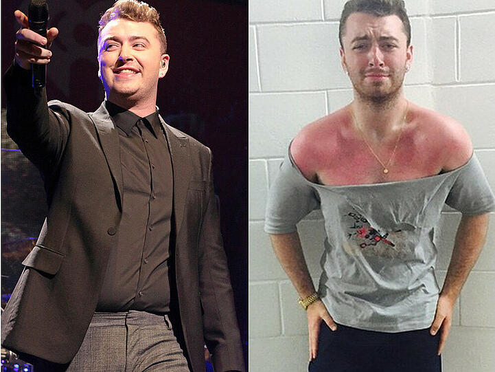 Vorher und nachher: Sam Smith im Dezember 2014 und im Juli 2015