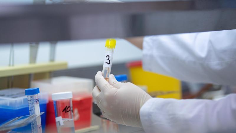 Eine Ärztin zeigt in einem Labor einen Test für das Coronavirus. Foto: Sebastian Gollnow/dpa/Symbolbild Eine Ärztin zeigt in einem Labor einen Test für das Coronavirus. Foto: Sebastian Gollnow/dpa/Symbolbild