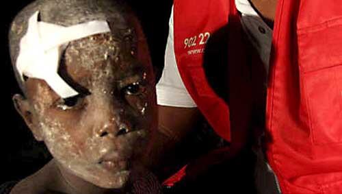 Die Menschen in Haiti sind auf internationale Hilfe angewiesen Die Menschen in Haiti sind auf internationale Hilfe angewiesen