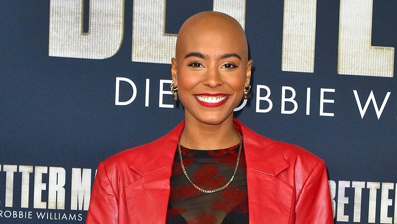 Sharon Battiste trägt seit 2022 eine Glatze. Bereits seit der Kindheit leidet sie an kreisrundem Haarausfall (Alopecia areata). Sharon Battiste trägt seit 2022 eine Glatze. Bereits seit der Kindheit leidet sie an kreisrundem Haarausfall (Alopecia areata).