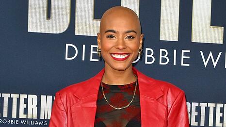 Sharon Battiste tr&auml;gt seit 2022 eine Glatze. Bereits seit der Kindheit leidet sie an kreisrundem Haarausfall (Alopecia areata).