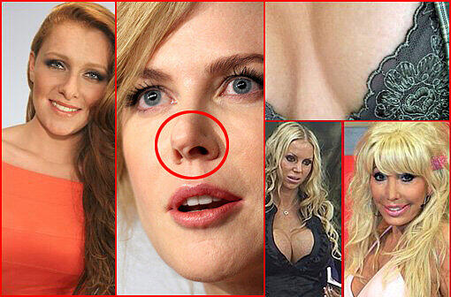 Wenn die Promis sich unters Messer legen, läuft nicht immer alles glatt. Was ist bloß mit dem hübschen Näschen von Nicole Kidman passiert?