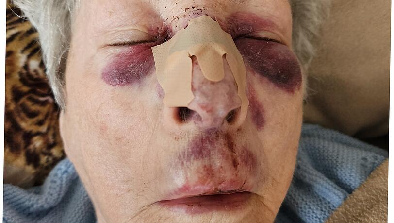 Hannelore O. nach ihrem schweren Sturz im Krankenhaus.