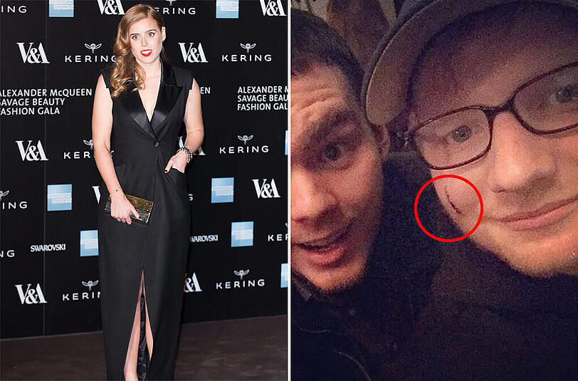 Blutige Schramme im Gesicht: Prinzessin Beatrice verletzt Ed Sheeran.