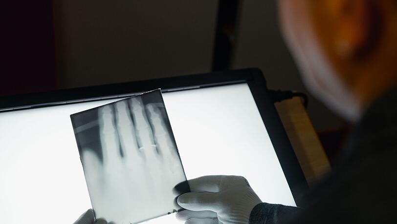 Ein Röntgenbild der Hand von Wilhelm Röntgen gehört nun zum  Unesco-Weltdokumentenerbe. (Archivbild)