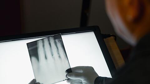 Ein Röntgenbild der Hand von Wilhelm Röntgen gehört nun zum  Unesco-Weltdokumentenerbe. (Archivbild)