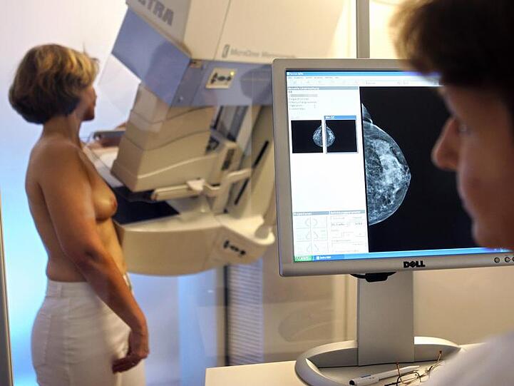 Mammographie (Archivbild)