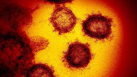 Eine undatierte elektronenmikroskopische Aufnahme des Coronavirus (SARS-CoV-2). Foto: NIAID-RML/AP/dpa/Archivbild