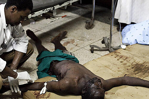 Schreckliche Bilder aus Uganda: Mindestens 64 Menschen wurden bei einem Bombenanschlag getötet