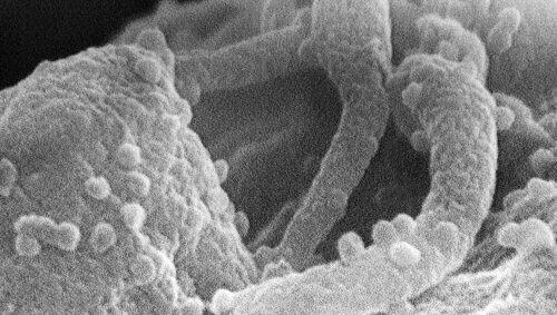 Obwohl Paul T. wusste, dass er mit dem HI-Virus infiziert ist, hatte er ungeschützten Sex. Obwohl Paul T. wusste, dass er mit dem HI-Virus infiziert ist, hatte er ungeschützten Sex.