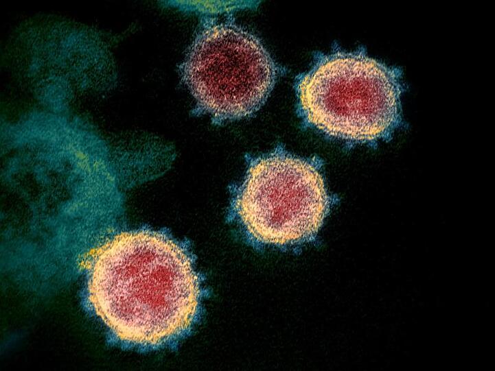 Undatierte elektronenmikroskopische Aufnahme, die vom U.S. National Institutes of Health im Februar 2020 zur Verfügung gestellt wurde, zeigt das Virus, das COVID-19 verursacht. Foto: Uncredited/NIAID-RML/via Ap/dpa/Archivbild