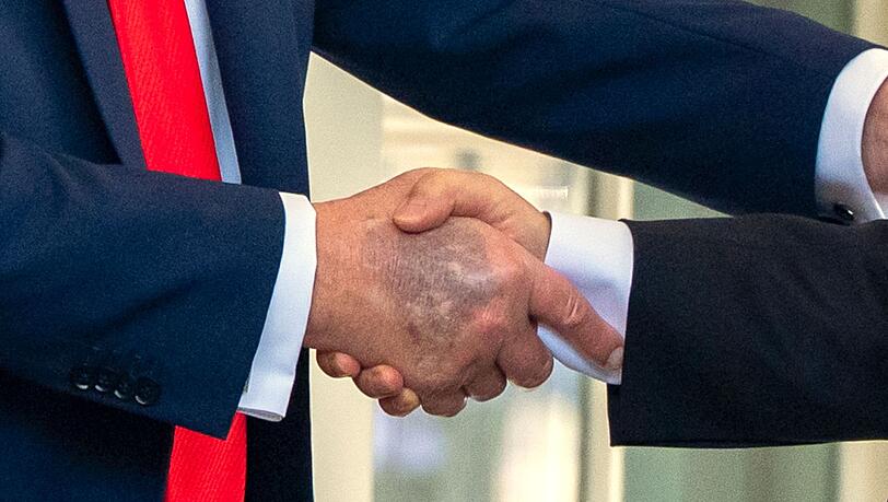 Zu sehen beim Händedruck mit dem südkoreanischen Präsidenten Lee: ein Bluterguss auf Trumps rechter Hand.