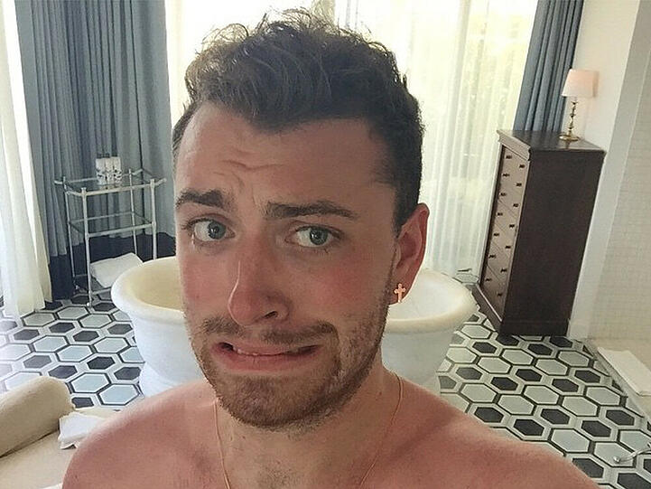 Autsch! Sam Smith zeigt seinen Followern seinen geröteten Oberkörper