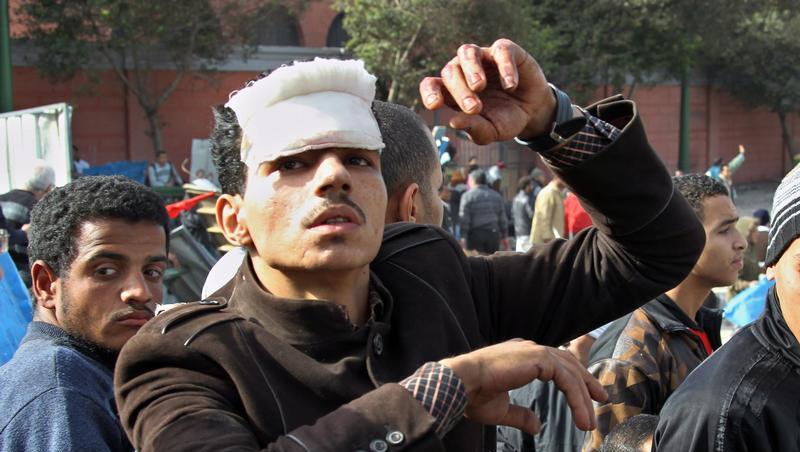 Bei den Protesten in Kairo kam es zu zahlreichen Verletzten Bei den Protesten in Kairo kam es zu zahlreichen Verletzten