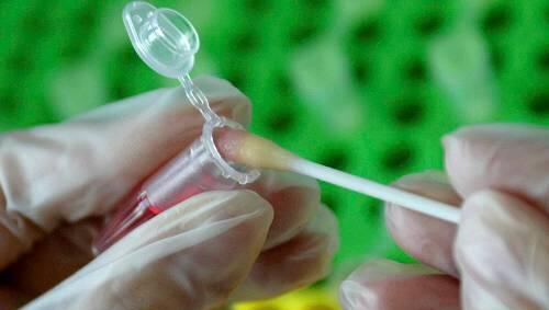 Eine Laborantin untersucht eine DNA-Probe, die sich auf einem Wattestäbchen befindet. Eine Laborantin untersucht eine DNA-Probe, die sich auf einem Wattestäbchen befindet.