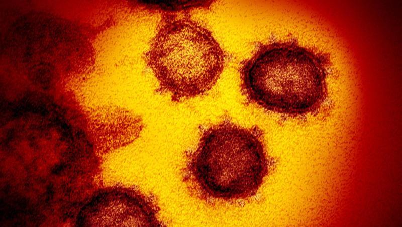 Eine undatierte elektronenmikroskopische Aufnahme des Coronavirus (SARS-CoV-2). Foto: NIAID-RML/AP/dpa/Archivbild Eine undatierte elektronenmikroskopische Aufnahme des Coronavirus (SARS-CoV-2). Foto: NIAID-RML/AP/dpa/Archivbild