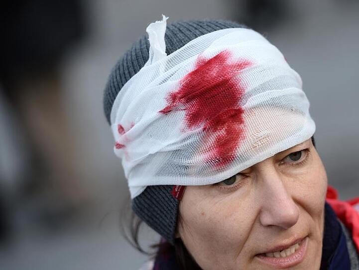 Eine Teilnehmerin einer Demonstration des "Aktionsbündnis gegen die NATO Sicherheitskonferenz" trägt einen Verband mit künstlichem Blut am Kopf. Foto: picture alliance / dpa/Archivbild