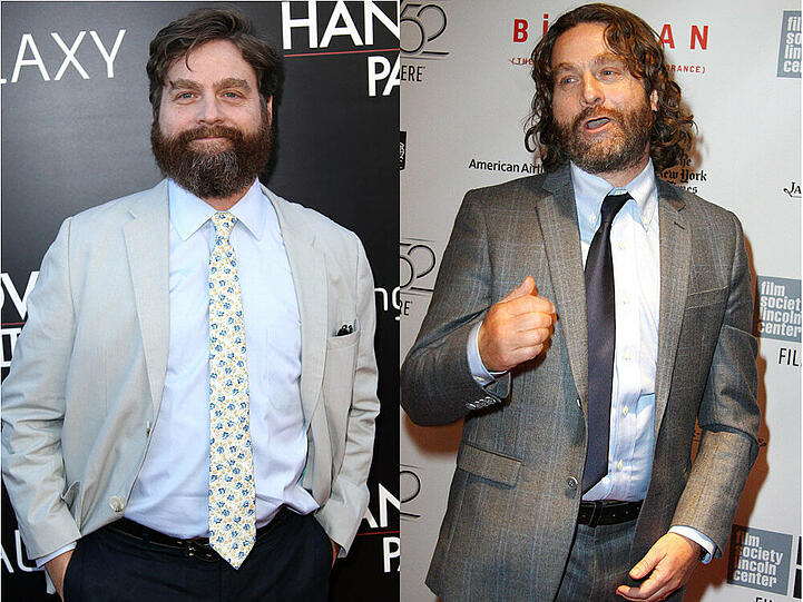 Zach Galifianakis ist kaum wiederzuerkennen