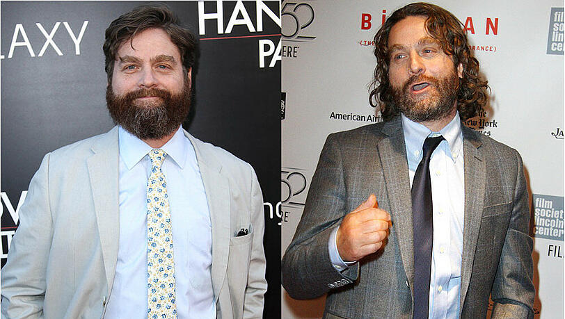 Zach Galifianakis ist kaum wiederzuerkennen