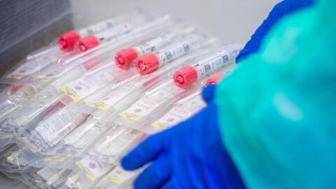 Testsets mit Abstrichstäbchen liegen in einem Testzentrum für Corona-Verdachtsfälle. (Symbolbild)
