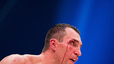 Wladimir Klitschko: Schwer gezeichnet vom Kampf gegen Tyson Fury.
