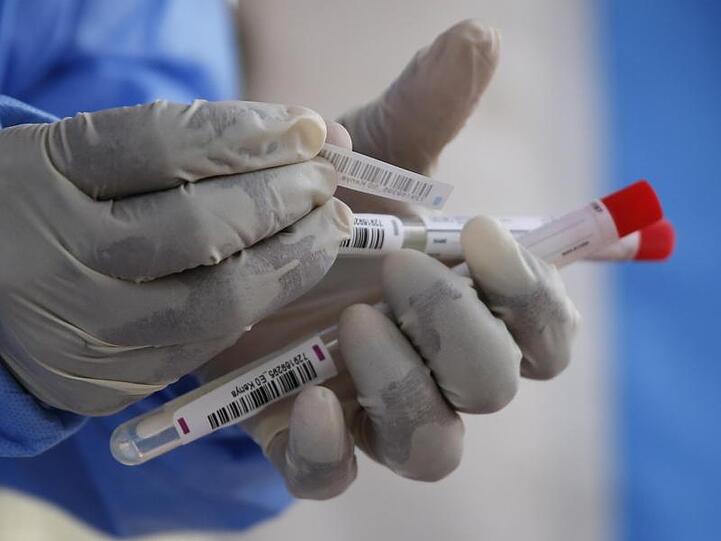 Eine Labortechnikerin bereitet Nasenabstriche für Tests auf das Coronavirus in einem pathologischen Labor vor.