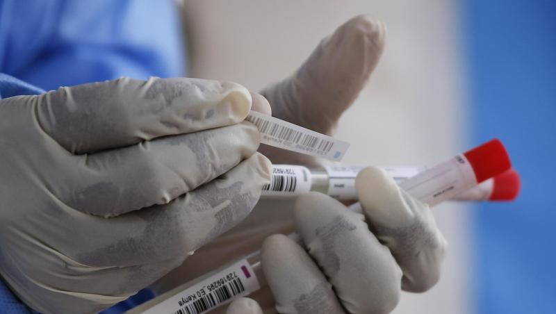 Eine Labortechnikerin bereitet Nasenabstriche für Tests auf das Coronavirus in einem pathologischen Labor vor. Eine Labortechnikerin bereitet Nasenabstriche für Tests auf das Coronavirus in einem pathologischen Labor vor.