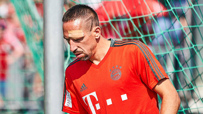 Mit einem Cut über dem Auge: Franck Ribéry vom FC Bayern.