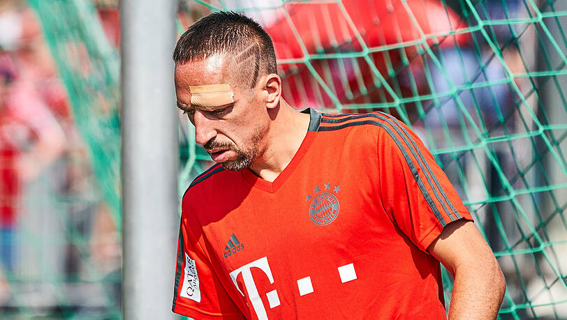 Mit einem Cut über dem Auge: Franck Ribéry vom FC Bayern. Mit einem Cut über dem Auge: Franck Ribéry vom FC Bayern.