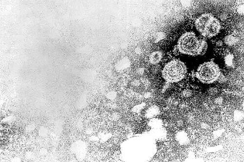 So sehen die fiesen Viren der Hepatitis B aus.