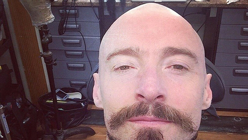Breaking Bald: Hugh Jackman mit Platte Breaking Bald: Hugh Jackman mit Platte