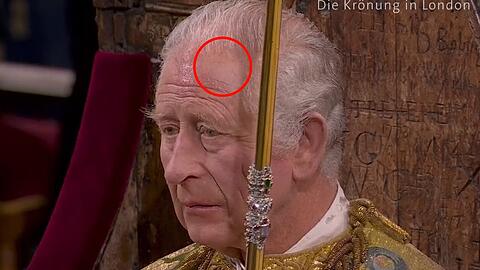 Deutlich zu sehen: Ein Pflaster klebt auf König Charles' Stirn
