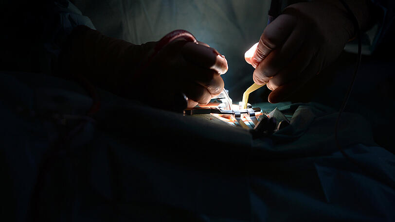 Ärzte unter Druck: Jedes Jahr melden sich Tausende Patienten mit Verdacht auf Behandlungsfehler bei der Bundesärztekammer.