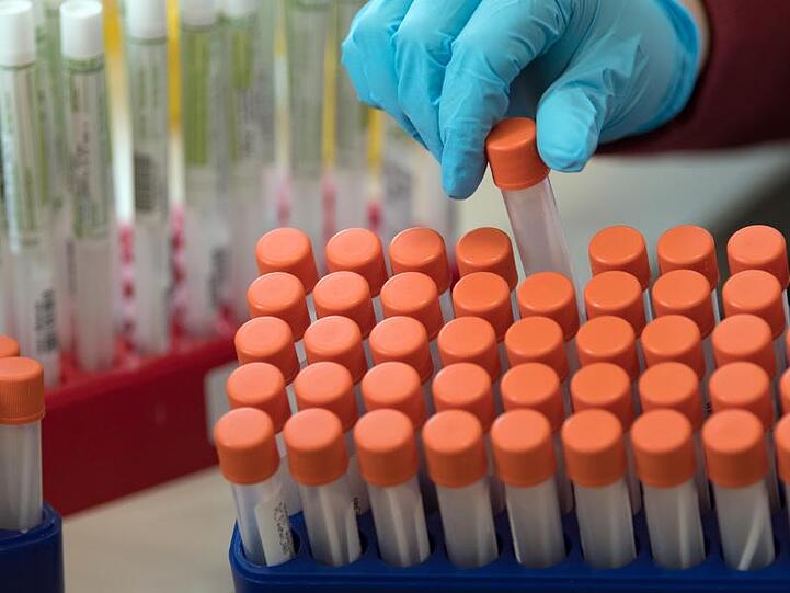 Proben für Corona-Tests werden für die weitere Untersuchung vorbereitet. Foto: Hendrik Schmidt/dpa-Zentralbild/ZB/Archivbild