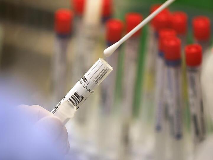 Ein Wattestäbchen mit einem Abstrich wird im Labor für einen Corona-Test verarbeitet. Foto: Oliver Berg/dpa/Symbolbild