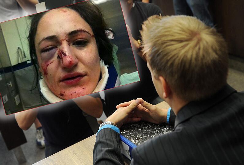 Teresa Z. wurde geschlagen: Der Polizist Frank W. bekam dafür zehn Monate auf Bewährung.