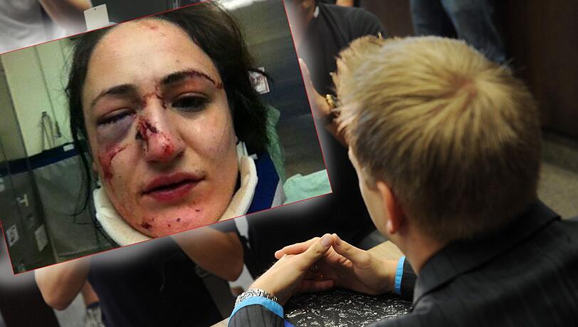 Teresa Z. wurde geschlagen: Der Polizist Frank W. bekam dafür zehn Monate auf Bewährung. Teresa Z. wurde geschlagen: Der Polizist Frank W. bekam dafür zehn Monate auf Bewährung.
