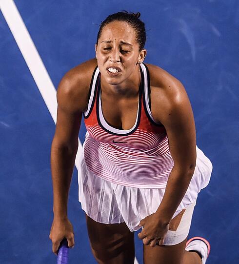 So nah liegen Freud' und Leid im Sport beieinander: die Chinesin Shuai Zhang profitierte im Achtelfinale der Australian Open von der Oberschenkelverletzung ihrer Gegnerin Madison Keys (USA). Die Bilder vom Drama.