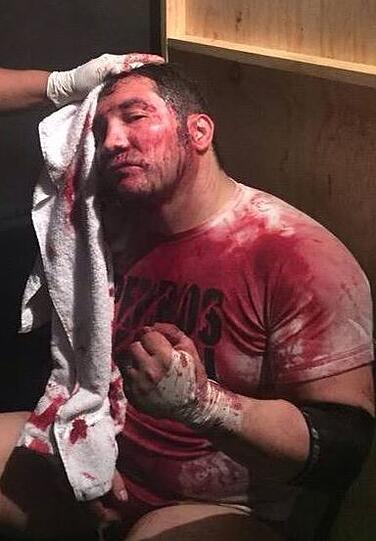 Der Wrestler El Hijo del Perro Aguayo stirbt während eines Kampfes im Ring