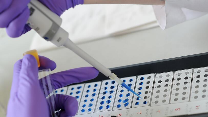 In der Regel kommt es laut dem LGL alle zwei bis drei Jahre zu Häufungen bei Hantavirus-Infektionen.