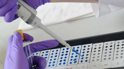 In der Regel kommt es laut dem LGL alle zwei bis drei Jahre zu Häufungen bei Hantavirus-Infektionen.