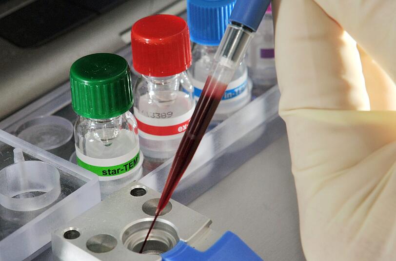 Sepsis (Blutvergiftung) ist weltweit eine häufige Todesursache. In Industrienationen steigt die Zahl der Erkrankungen seit Jahren wieder an. Foto: Jan-Peter Kasper/Archiv