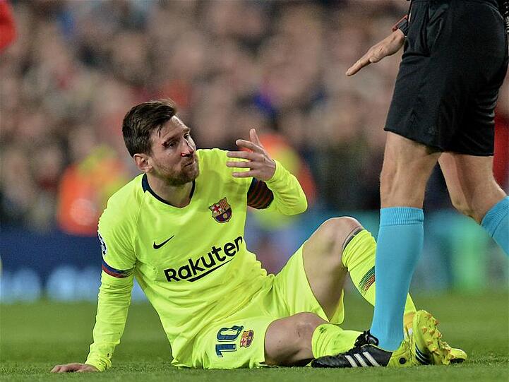 Lionel Messi bekam einen Schlag auf die Nase.