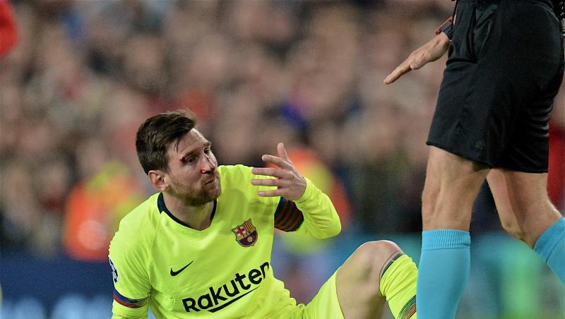 Lionel Messi bekam einen Schlag auf die Nase. Lionel Messi bekam einen Schlag auf die Nase.
