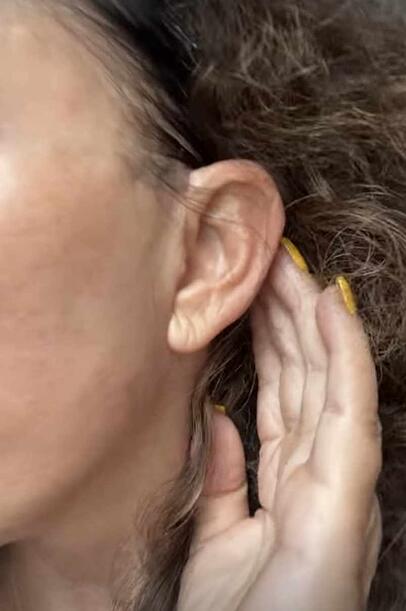 In ihrer Instagram-Story zeigt Natascha Ochsenknecht, wie ihr Gesicht nach der Straffung aussieht. In ihrer Instagram-Story zeigt Natascha Ochsenknecht, wie ihr Gesicht nach der Straffung aussieht.