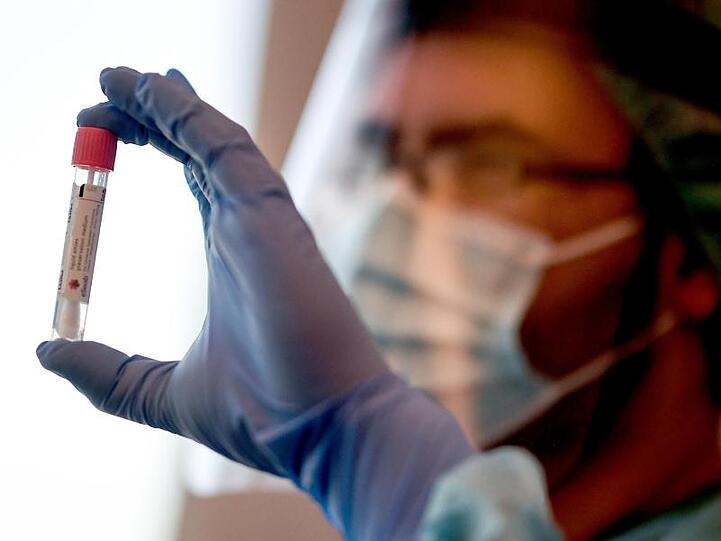 Noch nie seit Beginn der Coronavirus-Pandemie sind der Weltgesundheitsorganisation (WHO) innerhalb von 24 Stunden so viele Neuinfektionen gemeldet worden.