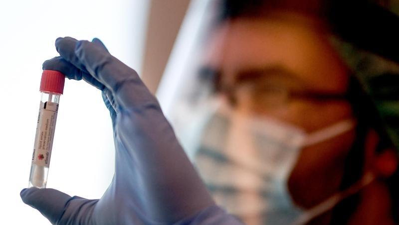 Noch nie seit Beginn der Coronavirus-Pandemie sind der Weltgesundheitsorganisation (WHO) innerhalb von 24 Stunden so viele Neuinfektionen gemeldet worden. Noch nie seit Beginn der Coronavirus-Pandemie sind der Weltgesundheitsorganisation (WHO) innerhalb von 24 Stunden so viele Neuinfektionen gemeldet worden.