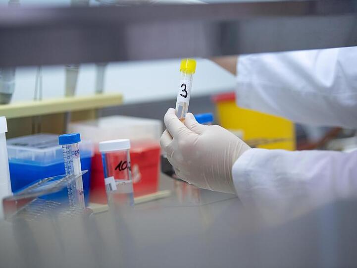Eine Frau zeigt einen Test für das neue Virus 2019-nCov. Foto: Sebastian Gollnow/dpa/Archivbild