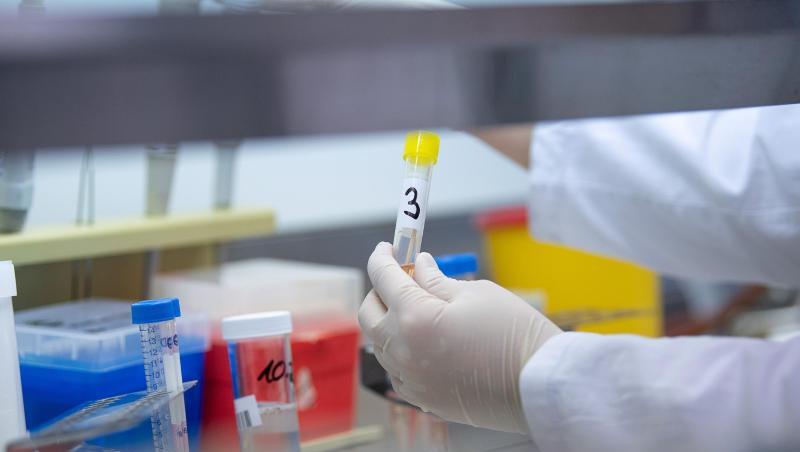 Eine Frau zeigt einen Test für das neue Virus 2019-nCov. Foto: Sebastian Gollnow/dpa/Archivbild Eine Frau zeigt einen Test für das neue Virus 2019-nCov. Foto: Sebastian Gollnow/dpa/Archivbild